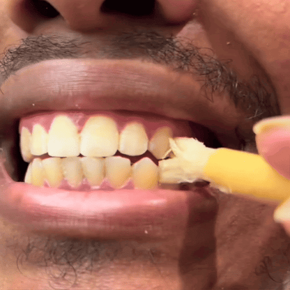 ✨ Miswak — Nature’s Original 7,000-Year-Old Toothbrush